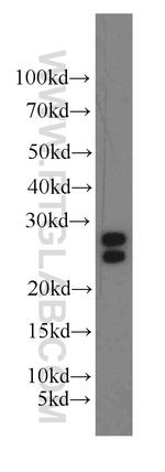 ARL2 Antibody in Western Blot (WB)