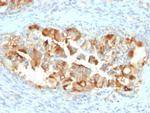 Mesothelin Antibody in Immunohistochemistry (Paraffin) (IHC (P))