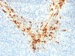 Mesothelin Antibody in Immunohistochemistry (Paraffin) (IHC (P))