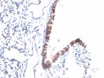 Mesothelin Antibody in Immunohistochemistry (Paraffin) (IHC (P))