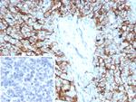 Mesothelin (Mesothelial Marker) Antibody in Immunohistochemistry (Paraffin) (IHC (P))