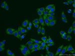 Transgelin 2 Antibody in Immunocytochemistry (ICC/IF)