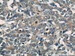 Transgelin 2 Antibody in Immunohistochemistry (Paraffin) (IHC (P))