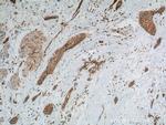 Transgelin 2 Antibody in Immunohistochemistry (Paraffin) (IHC (P))