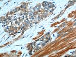 Transgelin 2 Antibody in Immunohistochemistry (Paraffin) (IHC (P))