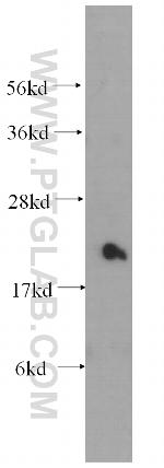 Transgelin 2 Antibody in Western Blot (WB)
