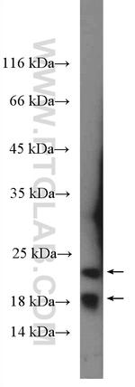 Transgelin 2 Antibody in Western Blot (WB)