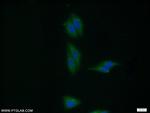 VPS35 Antibody in Immunocytochemistry (ICC/IF)