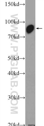 VPS35 Antibody in Western Blot (WB)