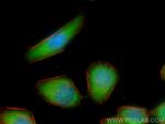 S100A11 Antibody in Immunocytochemistry (ICC/IF)