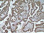 S100A11 Antibody in Immunohistochemistry (Paraffin) (IHC (P))