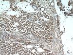 S100A11 Antibody in Immunohistochemistry (Paraffin) (IHC (P))