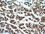 S100A11 Antibody in Immunohistochemistry (Paraffin) (IHC (P))