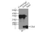S100A11 Antibody in Immunoprecipitation (IP)