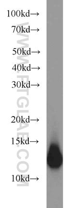 S100A11 Antibody in Western Blot (WB)