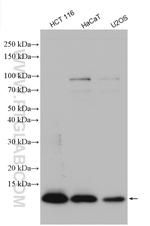 S100A11 Antibody in Western Blot (WB)