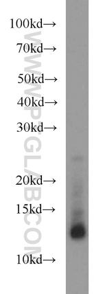 S100A11 Antibody in Western Blot (WB)