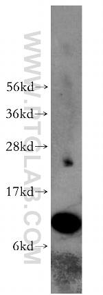 S100A11 Antibody in Western Blot (WB)