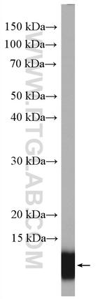 S100A11 Antibody in Western Blot (WB)