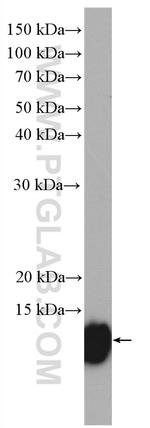 S100A11 Antibody in Western Blot (WB)