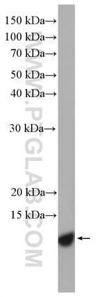 S100A11 Antibody in Western Blot (WB)