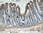 PLEKHA1 Antibody in Immunohistochemistry (Paraffin) (IHC (P))