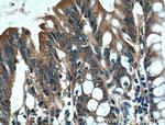 PLEKHA1 Antibody in Immunohistochemistry (Paraffin) (IHC (P))