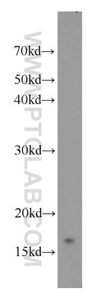 UBC13 Antibody in Western Blot (WB)