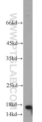 UBC13 Antibody in Western Blot (WB)