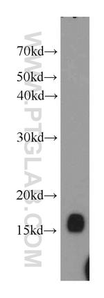 UBC13 Antibody in Western Blot (WB)