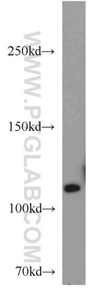 USP11 Antibody in Western Blot (WB)