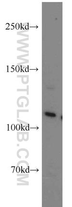 USP11 Antibody in Western Blot (WB)