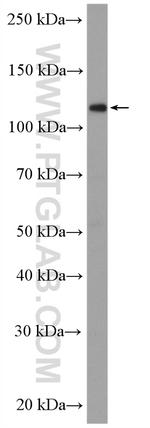 USP11 Antibody in Western Blot (WB)