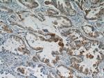 S100A6 Antibody in Immunohistochemistry (Paraffin) (IHC (P))