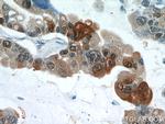 S100A6 Antibody in Immunohistochemistry (Paraffin) (IHC (P))