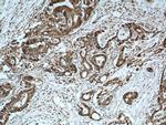 S100A6 Antibody in Immunohistochemistry (Paraffin) (IHC (P))