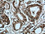 S100A6 Antibody in Immunohistochemistry (Paraffin) (IHC (P))