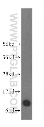 S100A6 Antibody in Western Blot (WB)