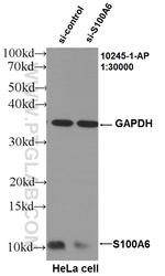 S100A6 Antibody in Western Blot (WB)