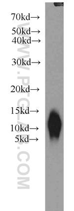 S100A6 Antibody in Western Blot (WB)