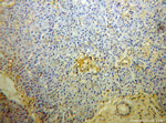 GNB1 Antibody in Immunohistochemistry (Paraffin) (IHC (P))