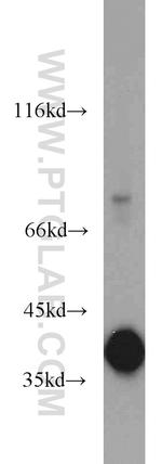 GNB1 Antibody in Western Blot (WB)