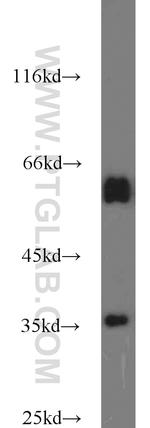 GNB1 Antibody in Western Blot (WB)