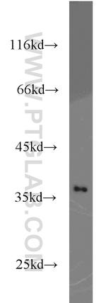 GNB1 Antibody in Western Blot (WB)