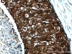 GDI1 Antibody in Immunohistochemistry (Paraffin) (IHC (P))