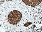 GDI1 Antibody in Immunohistochemistry (Paraffin) (IHC (P))