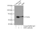 GDI1 Antibody in Immunoprecipitation (IP)