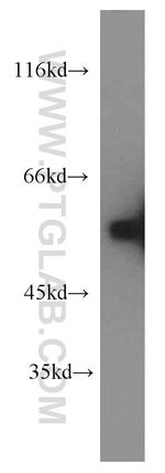 GDI1 Antibody in Western Blot (WB)