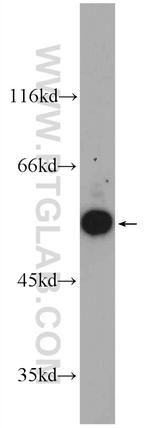 GDI1 Antibody in Western Blot (WB)