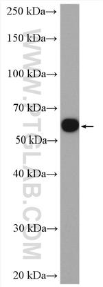 GDI1 Antibody in Western Blot (WB)